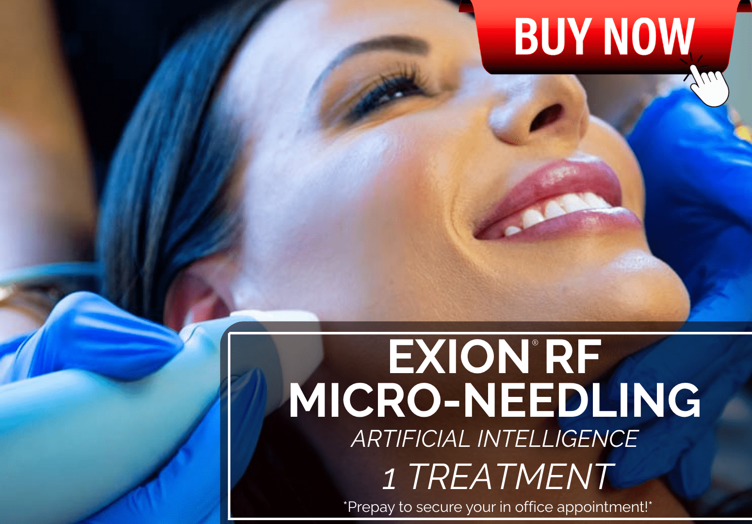EXION RF MICRONEEDLING AI TREATMENT