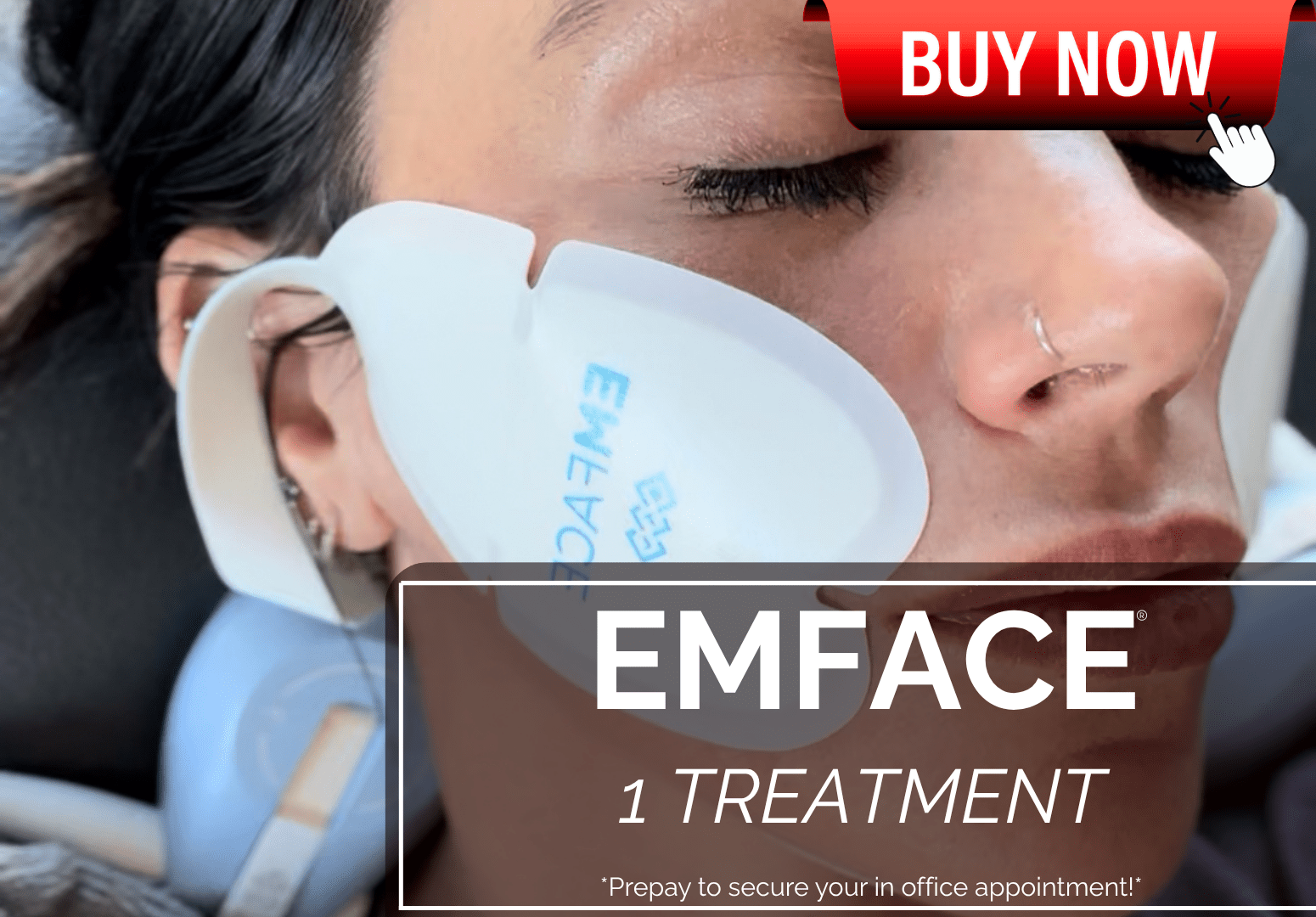 EMFACE TREATMENT