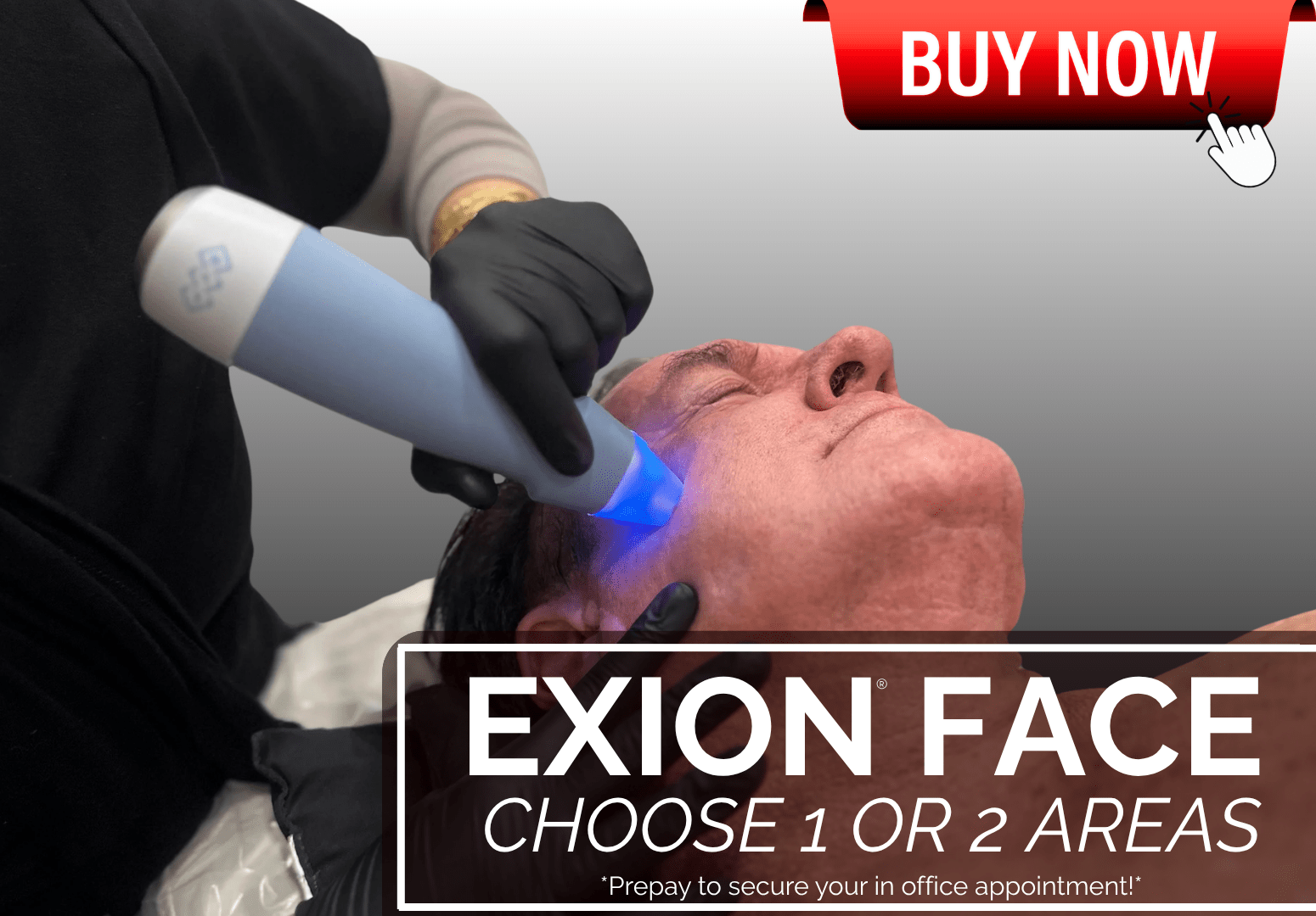 EXION FACE ULTRASOUND + RF DUAL TREATMENT