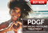 PDGF WITH DRY MICRONEEDLING