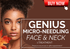 GENIUS RF MICRONEEDLING LASER : FACE & NECK