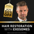BLACK FRIDAY EXOSOMES HAIR LOSS TREATMENT