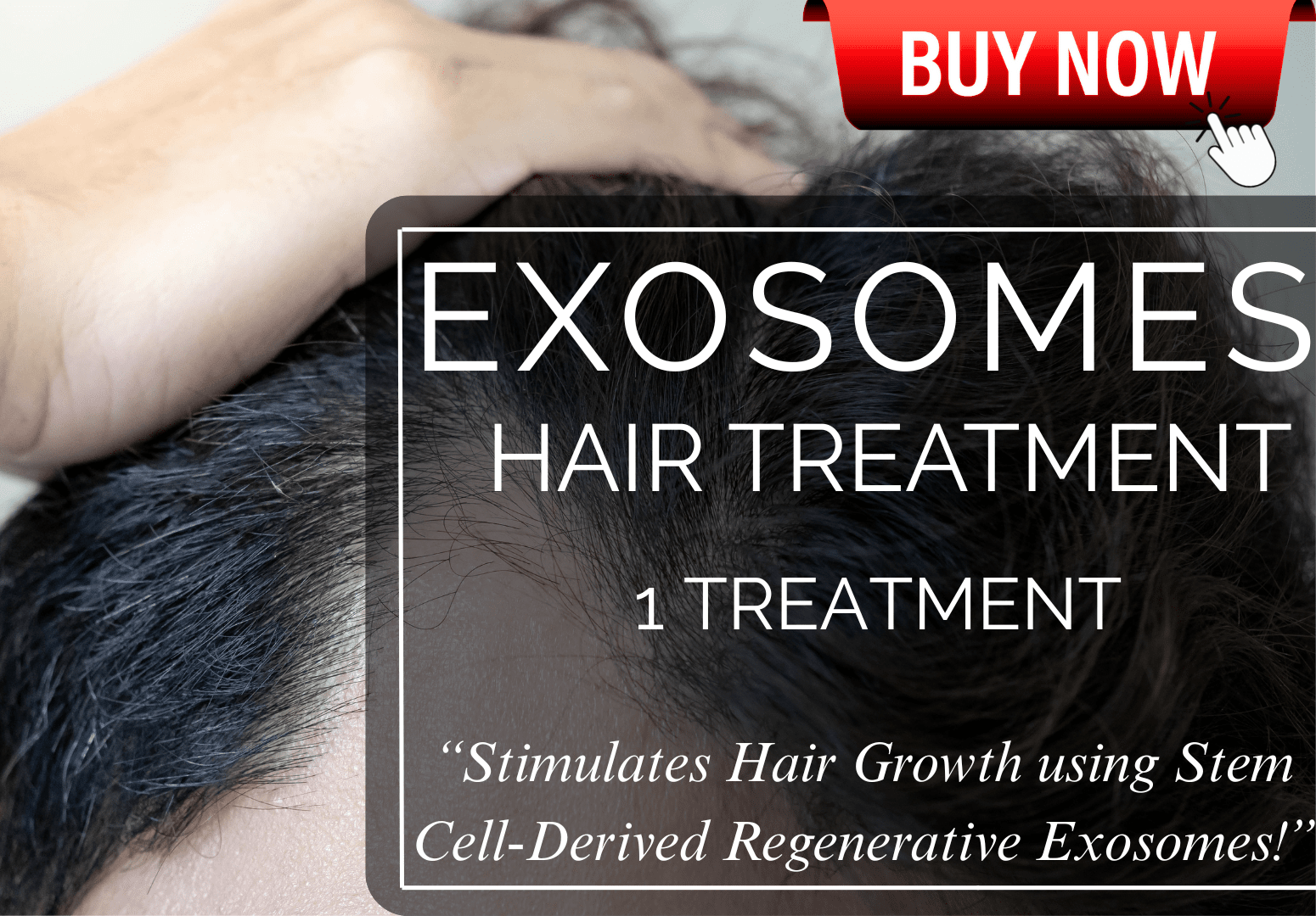 EXOSOME HAIR THERAPY TREATMENT
